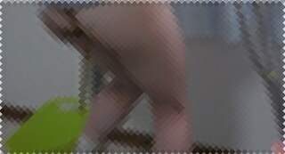 【病院脱糞】足が痛い！お腹も痛い！うんこ撒き散らしながらトイレに向かう松葉杖のデカ尻女性。